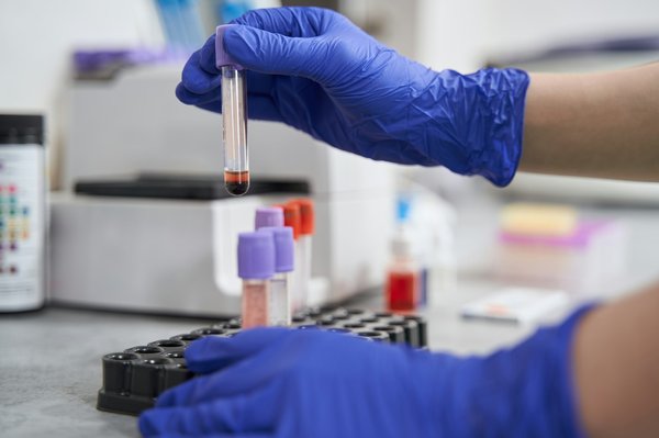 Comment mettre en place une politique de ressources humaines efficace